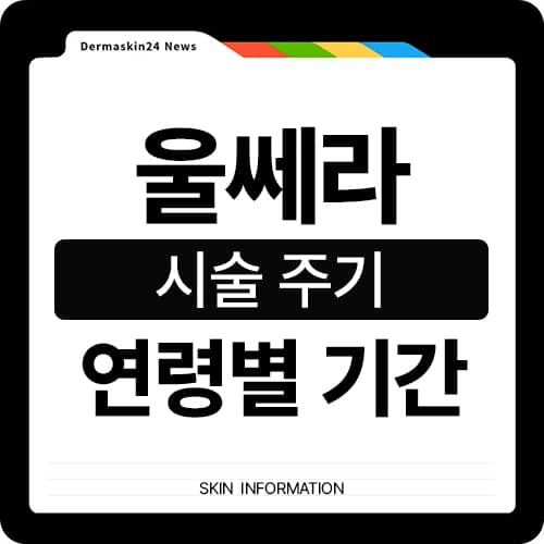 울쎄라 주기